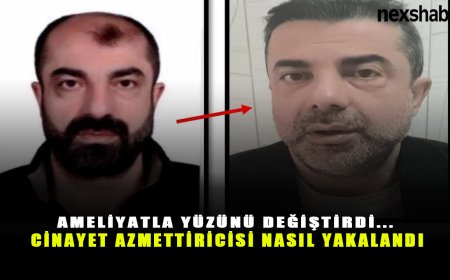Film sahnesini aratmayan olay: Ameliyatla yüzünü değiştirdi... Cinayet azmettiricisi nasıl yakalandı